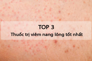 Top 3 thuốc trị viêm nang lông hiệu quả nhất hiện nay