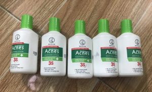Acnes Soothing Lotion con co mui khang khuan nen kha kho chiu khi su dung lan dau tien