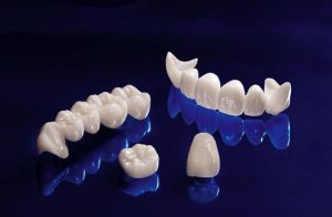 Rang su Zirconia 1