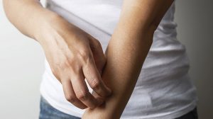 ngua ngay kho chiu la trieu chung dien hinh cua tinh trang benh khi tai di phat lai nhieu lan